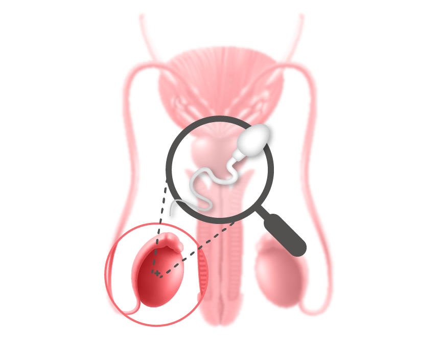Für Spermien ist es nicht leicht, die Eileiter für die potenzielle Befruchtung zu erreichen.